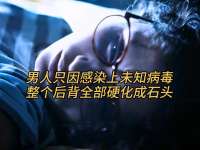 男人只因感染上未知病毒，整个后背全部硬化成石头