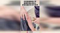 中医拔罐神技大赏，用酒杯吸在皮肤上，感觉里面的药水不简单！