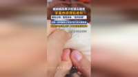 男子在医院就医时吃馒头“噎死”，家属申请理赔被拒，法院判了