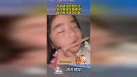 不是遗传的地包天，女儿每天咬着棍子，据说有改善的可能！