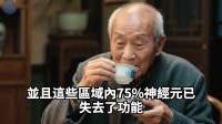 医生警示：老年痴呆元凶竟是这3种饮食！及早改掉，受益无穷！