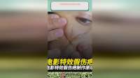 电影特效假伤疤制作原理